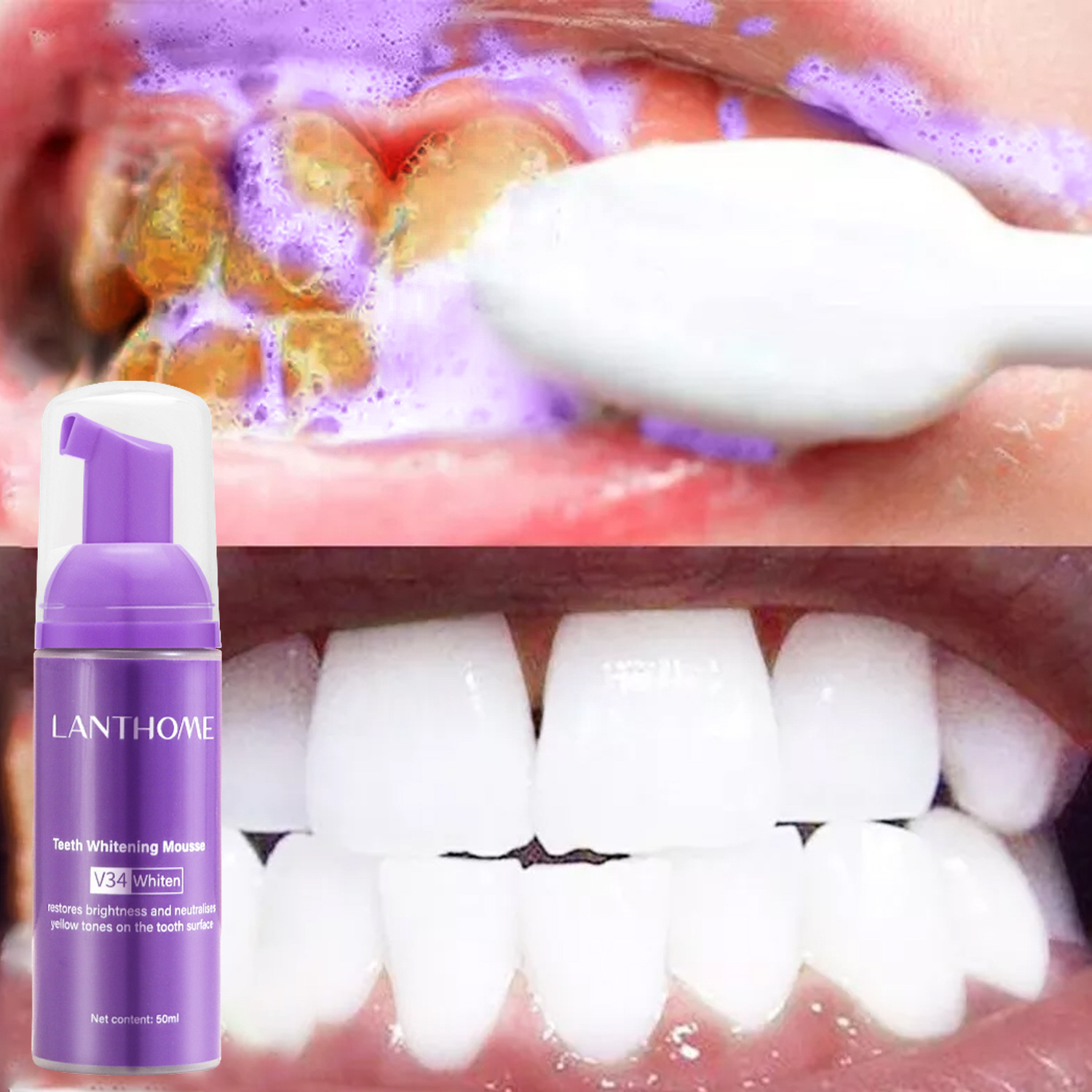 Teeth Whitening/Bleaching - V34 мусс для отбеливания зубов, зубная