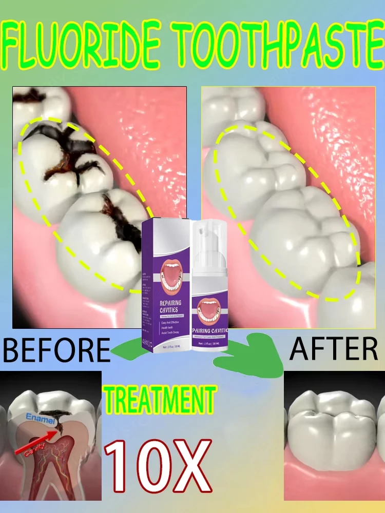 Teeth Whitening That Works - Горячие продажи. Самые продаваемые научные восстановления