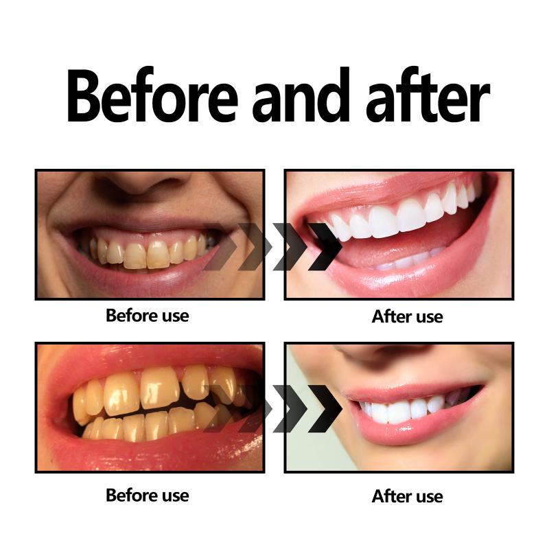 Порошок для отбеливания зубов  – обзор и цена Whitening Teeth Using Baking Soda
