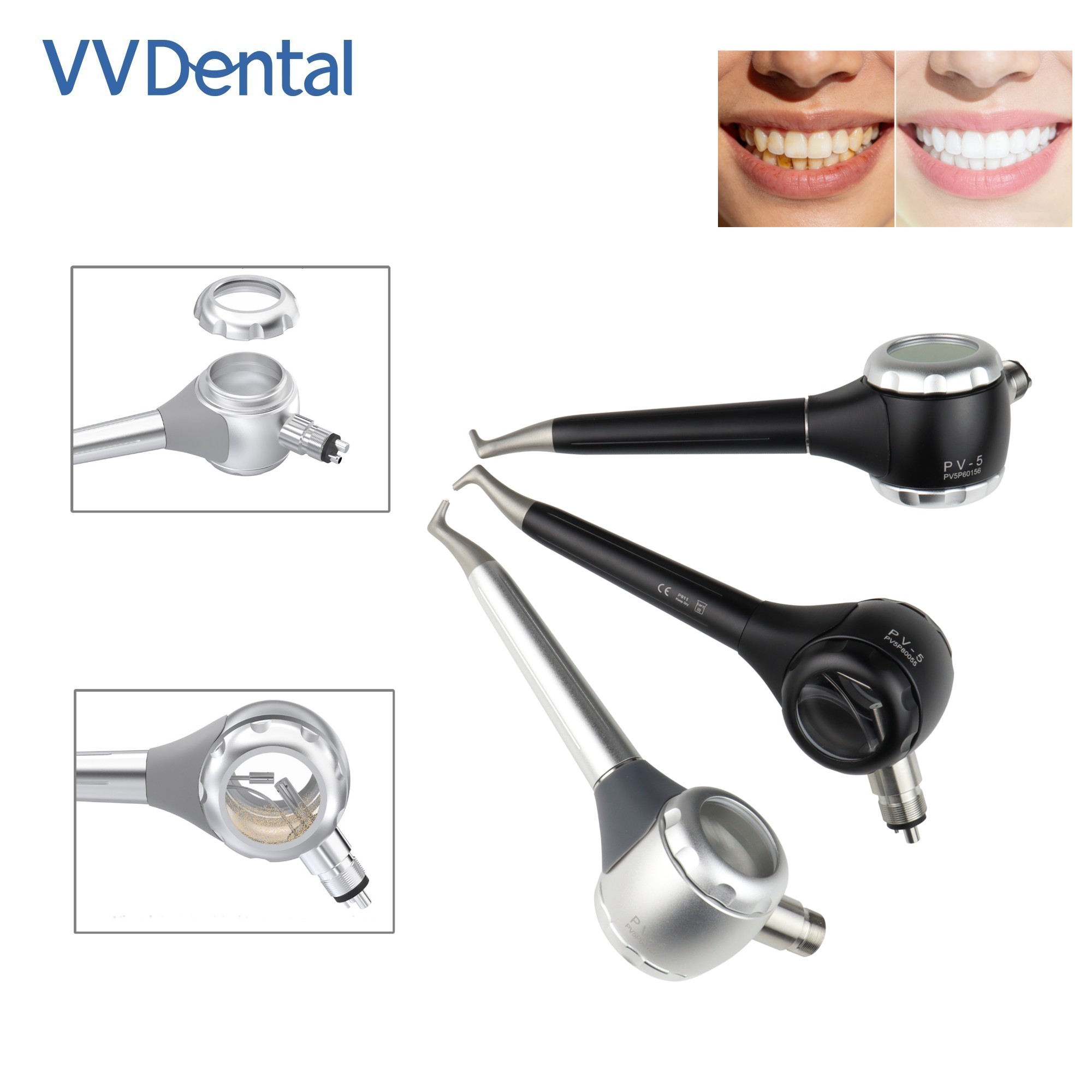 Стоматологический пескоструйны – обзор и цена Teeth Whitening Usa