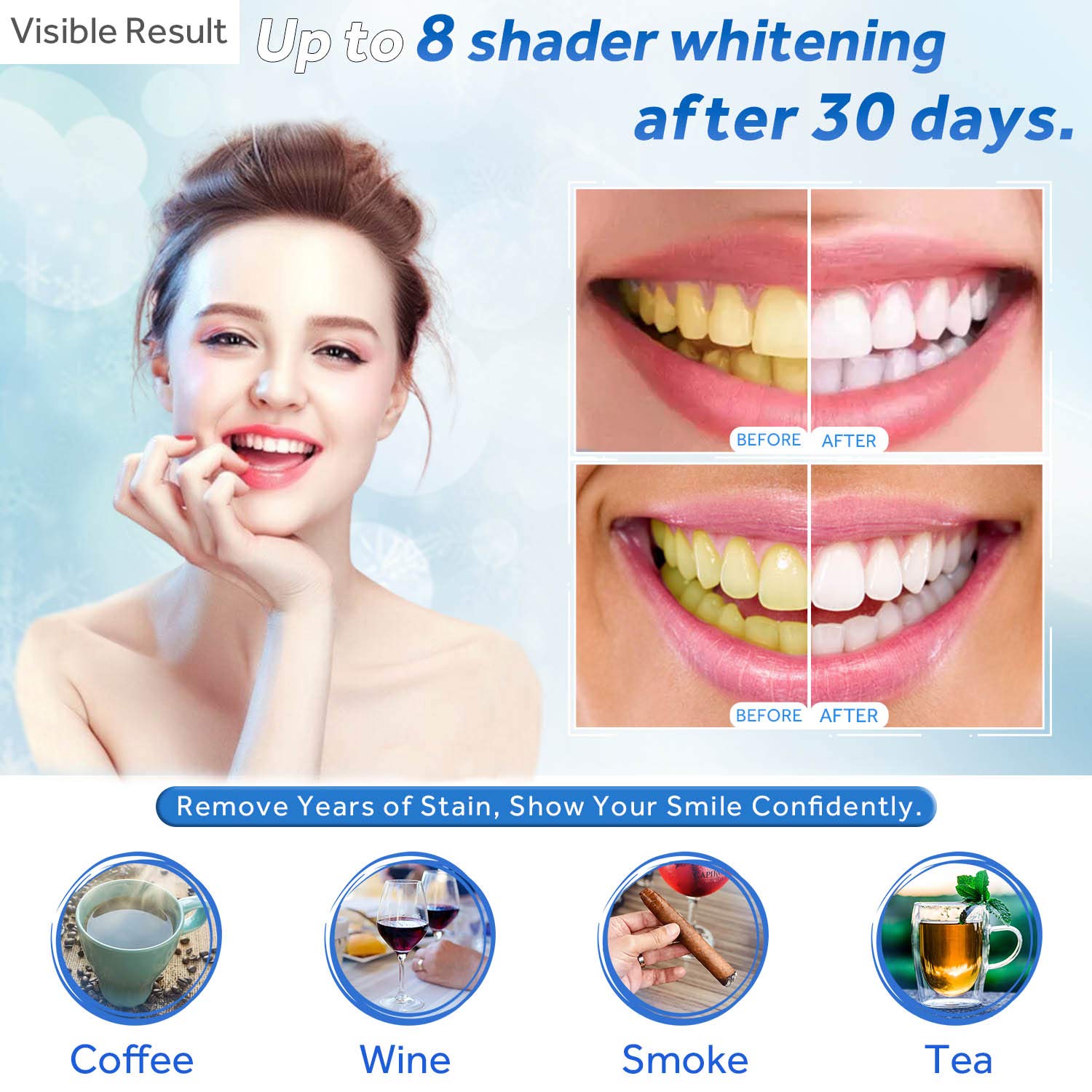 Гель для отбеливания зубов, шп – обзор и цена Teeth Whitening Gel Syringes