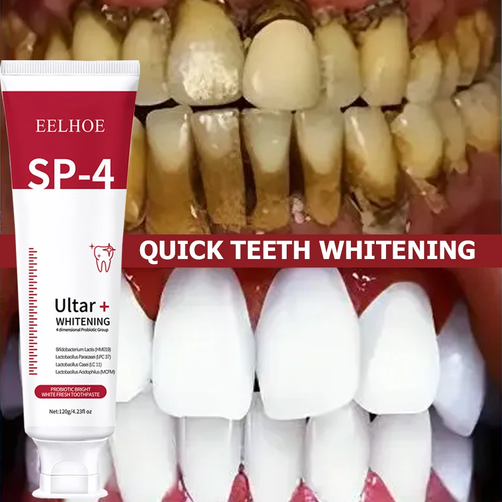 5 шт., детская отбеливающая зу – обзор и цена Teeth Whitening Enzymes