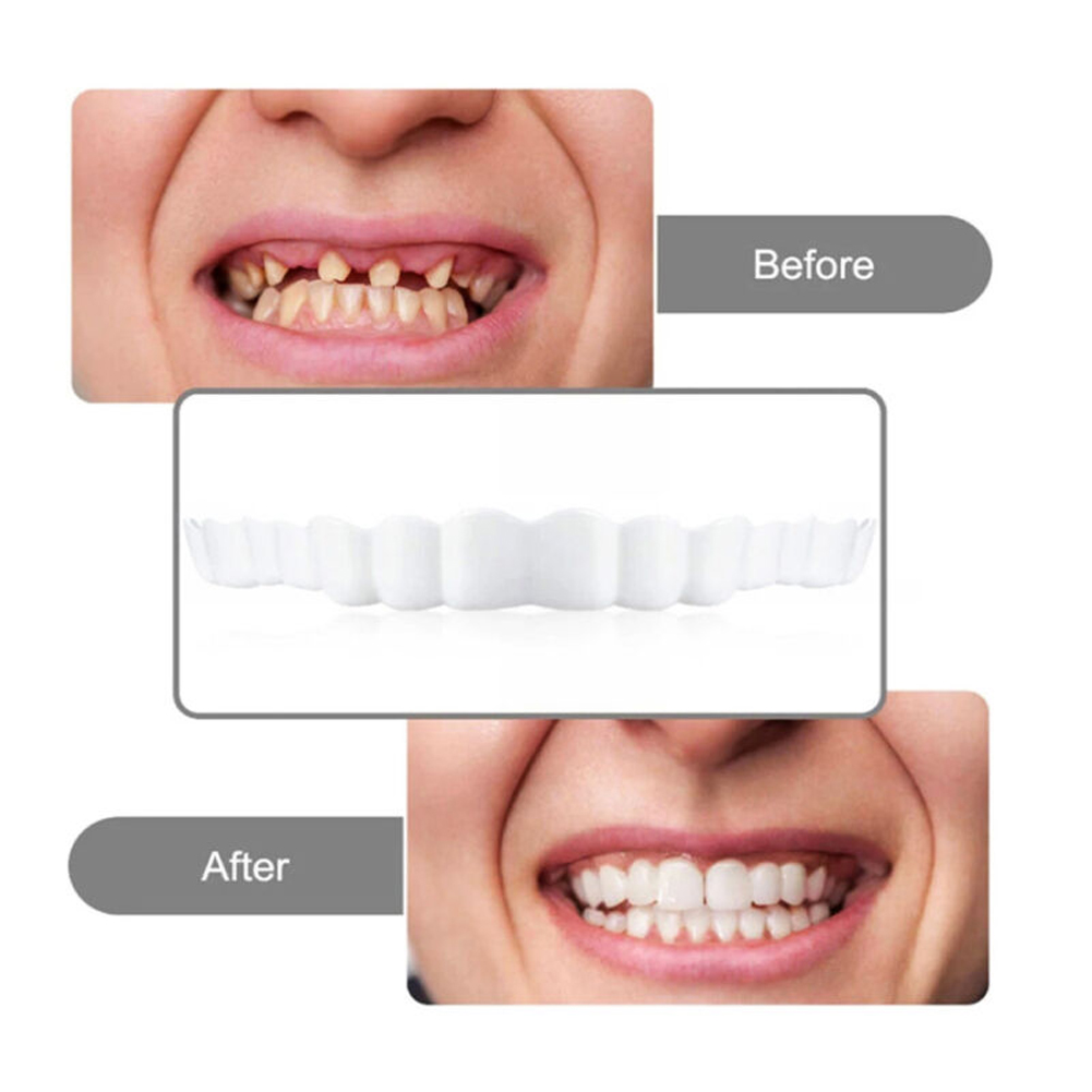 Новый силиконовый набор для вр – обзор и цена Teeth Whitening Usa