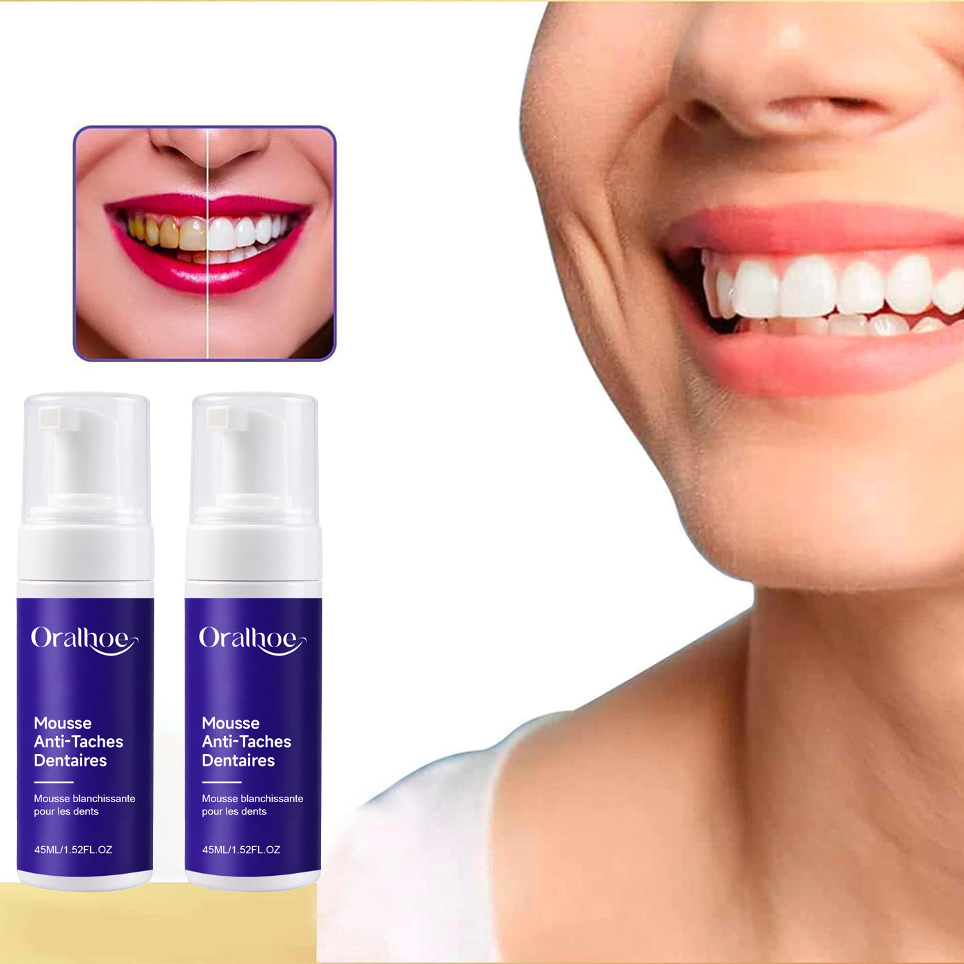 Фиолетовая пенящаяся зубная па – обзор и цена Teeth Whitening Routine