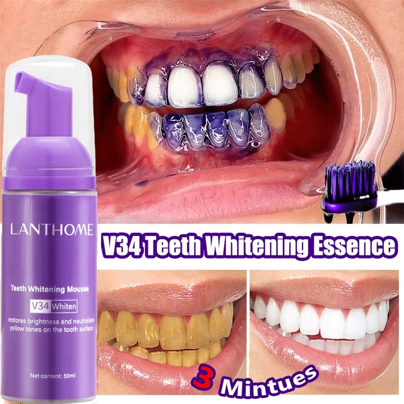 V34 мусс для отбеливания зубов – обзор и цена Teeth Whitening/Bleaching