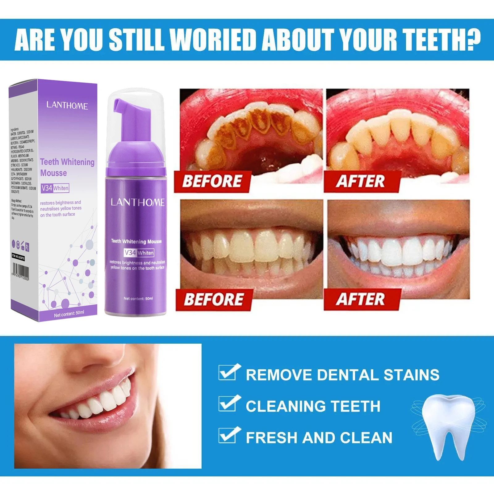 V34 мусс для отбеливания зубов – обзор и цена Teeth Whitening/Bleaching