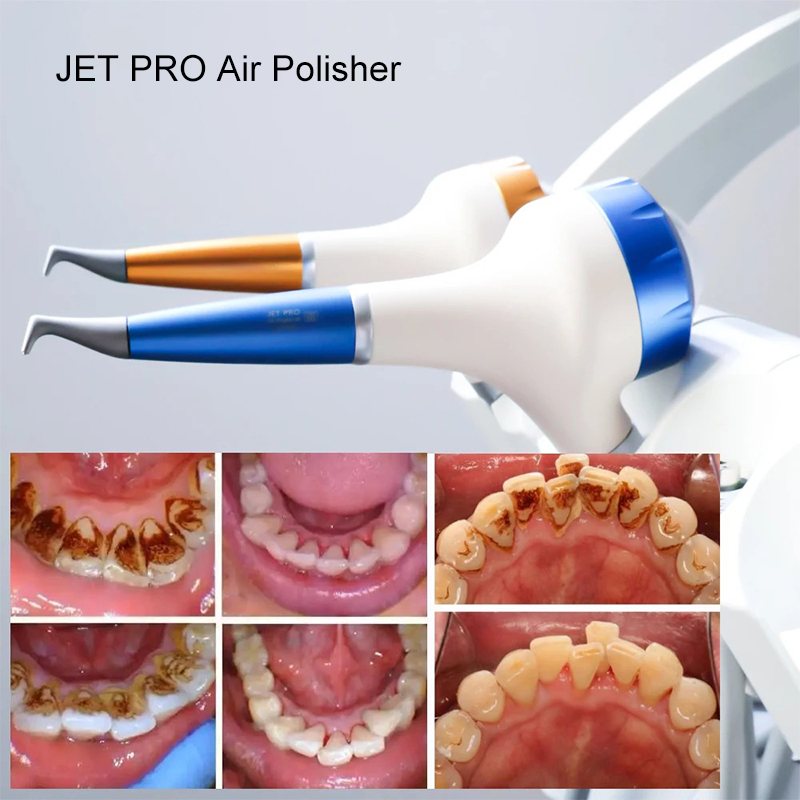 Стоматологический аппарат VV D – обзор и цена Teeth Whitening Usa