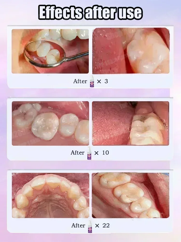 Горячие продажи. Самые продава – обзор и цена Teeth Whitening Toothpaste