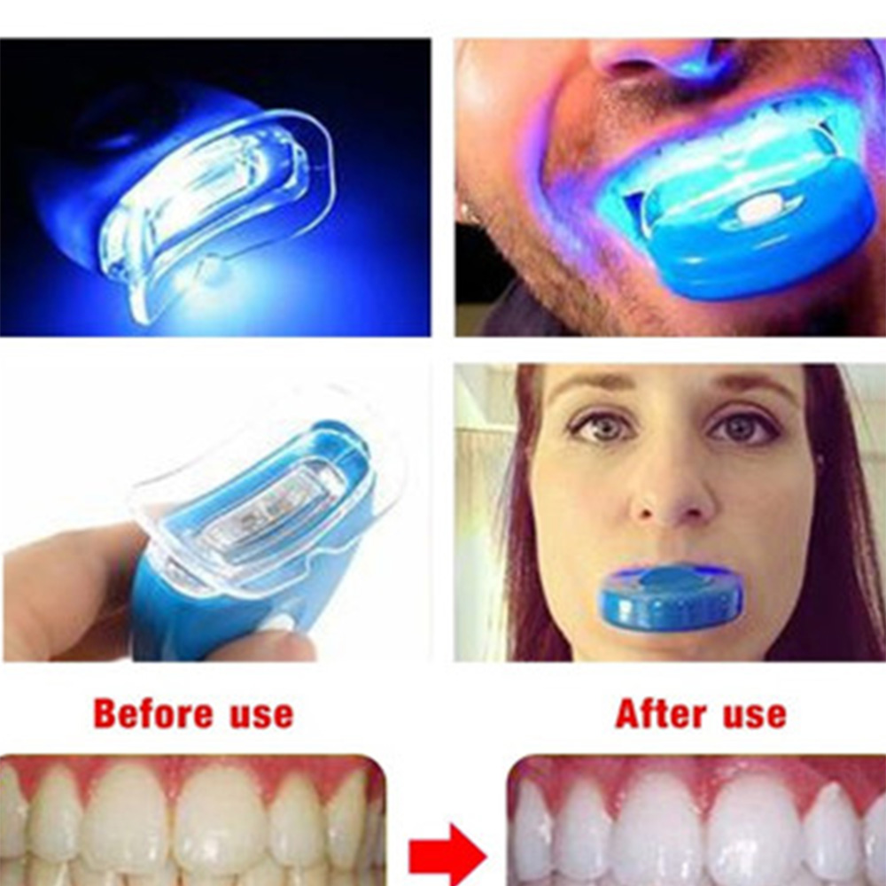 Новый синий светодиод отбелива – обзор и цена Teeth Whitening With Laser