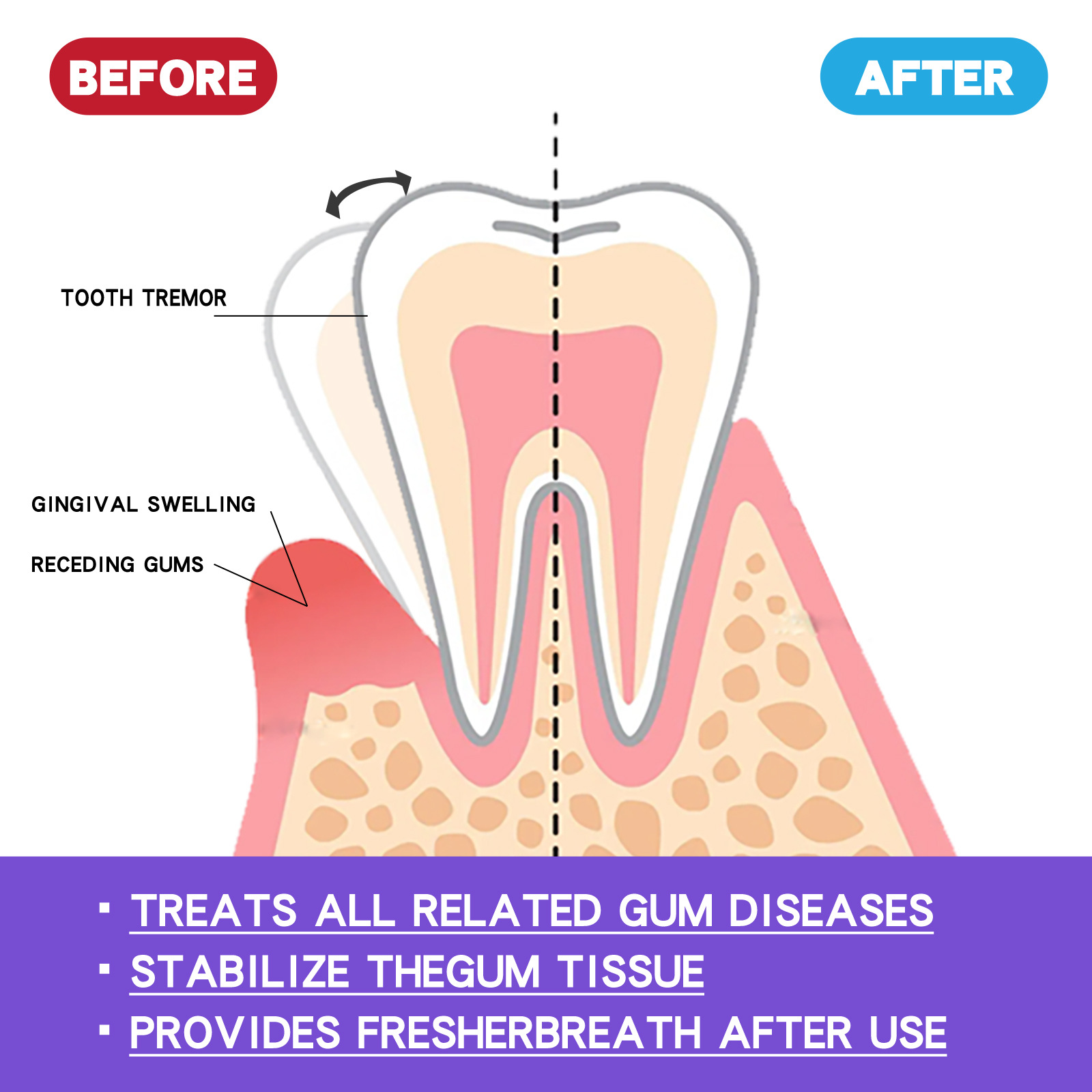 60 мл мусс для отбеливания зуб – обзор и цена Teeth Whitening Toothpaste