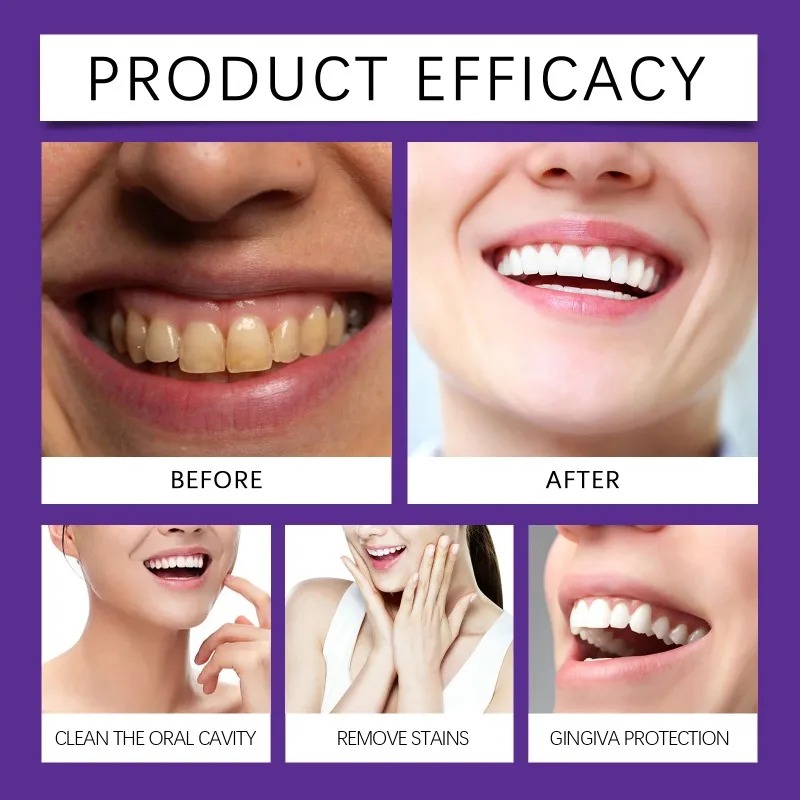 Минеральный порошок для восста – обзор и цена Teeth Whitening Toothpaste