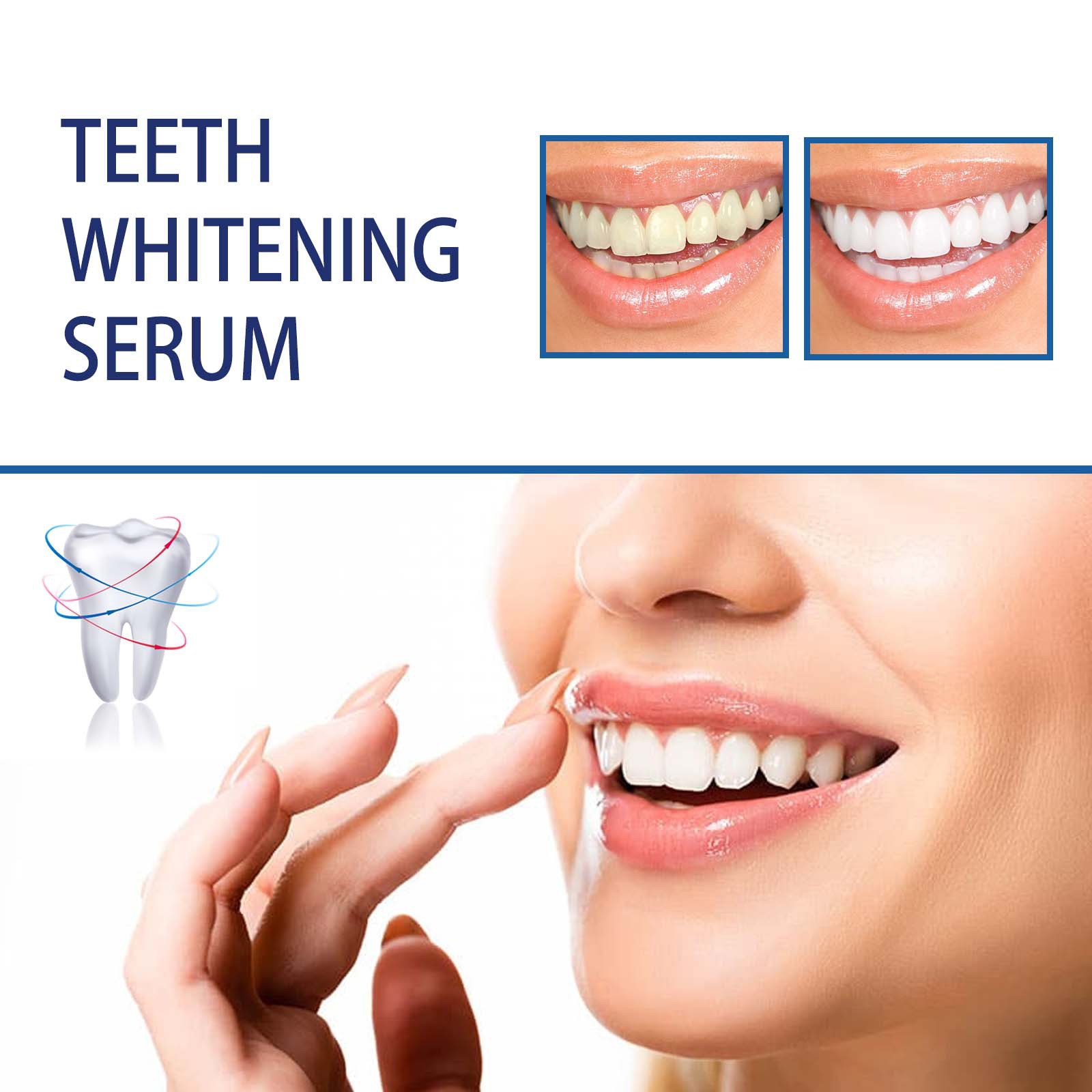 Профессиональная сыворотка для – обзор и цена Teeth Whitening/Bleaching
