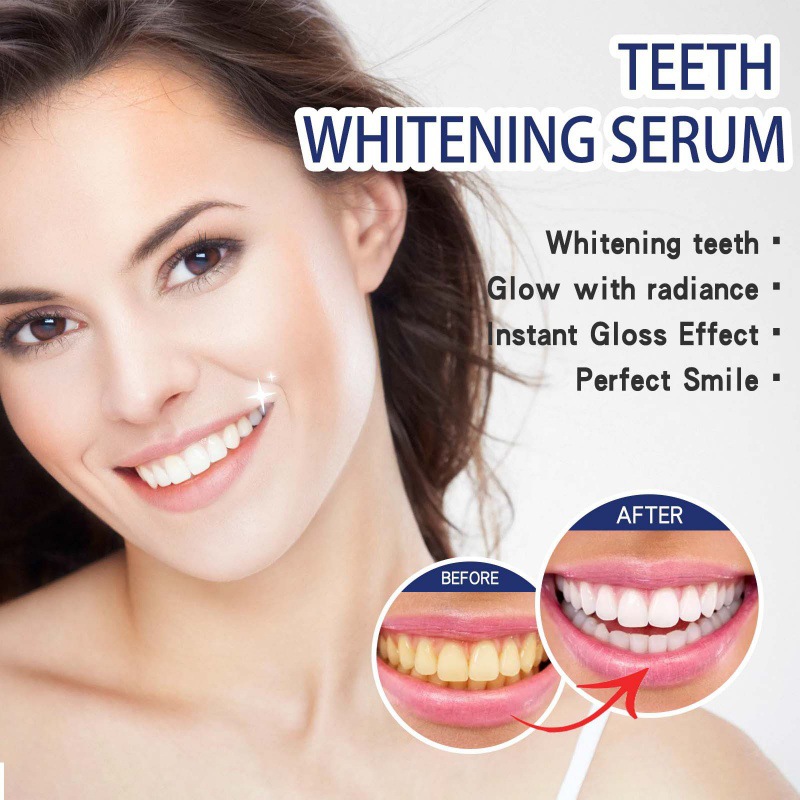 Профессиональная сыворотка для – обзор и цена Teeth Whitening/Bleaching