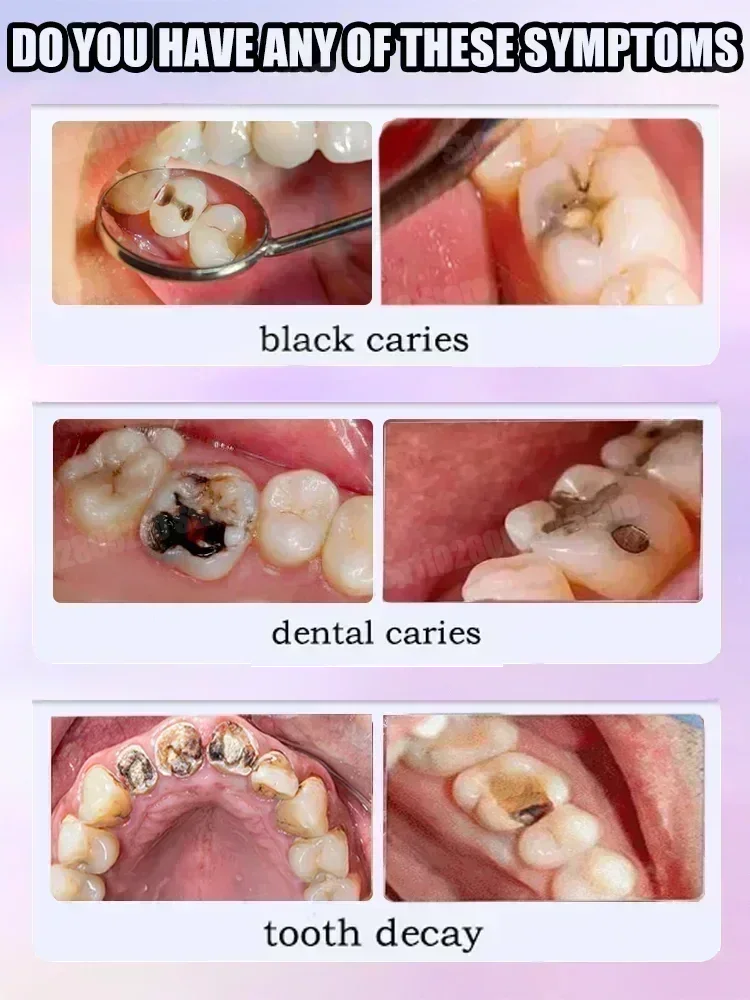 Зубная паста для чистки зубов  – обзор и цена Teeth Whitening That Works